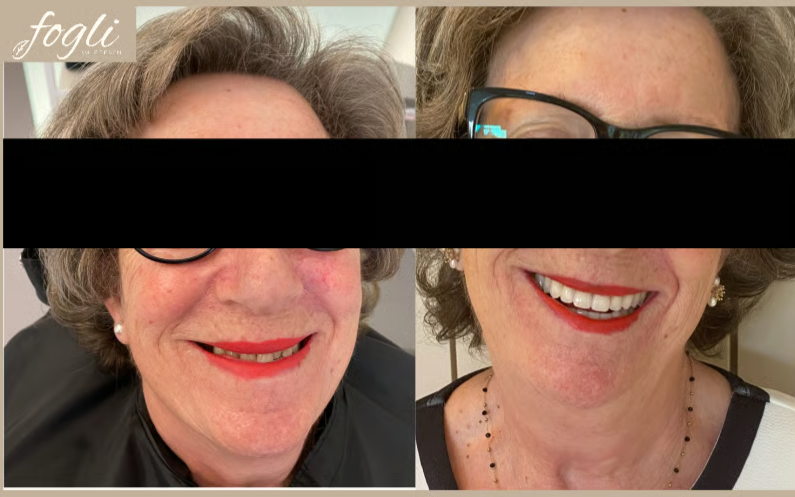 Split portrait collage of a woman with glasses and red lipstick, partly covered by a black horizontal bar.