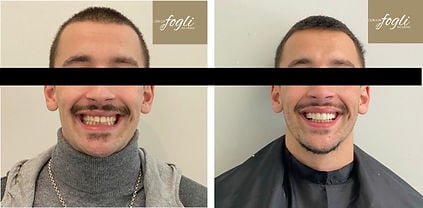 Diagnóstico do sorriso em 3D